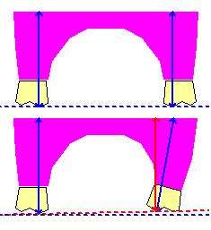 lack of vertical dimension