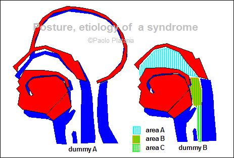 Airflow asymmetric afferences localization