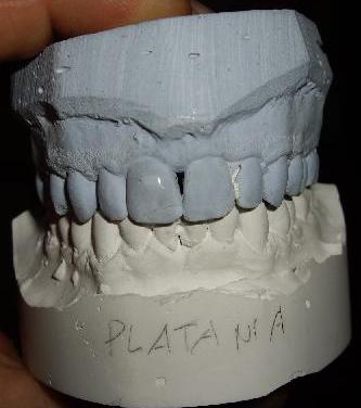 planas on mandibular arch after