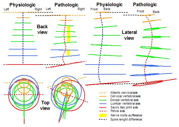 Spine torsional model