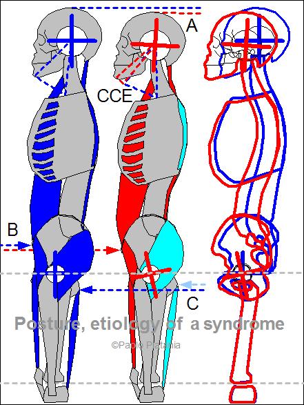 Anterior Pelvic Tilt. B anterior pelvis downward